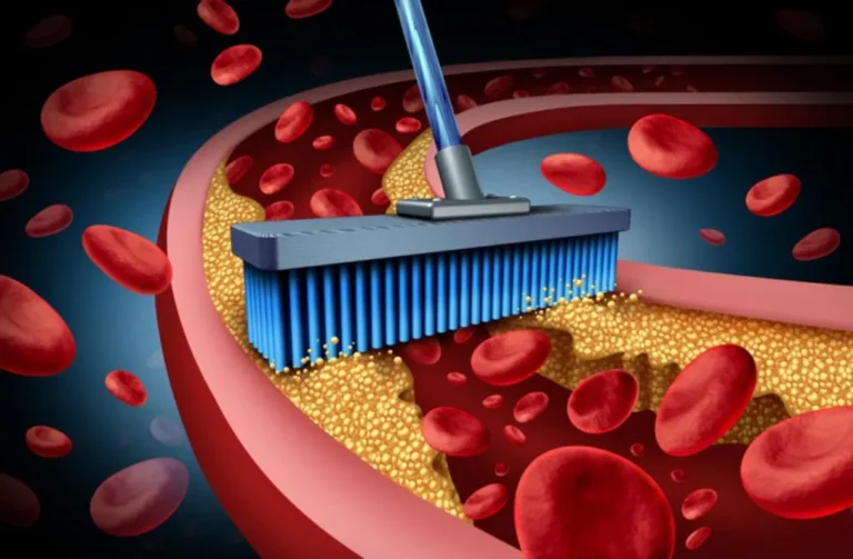 chelation_therapy_720-1024x671