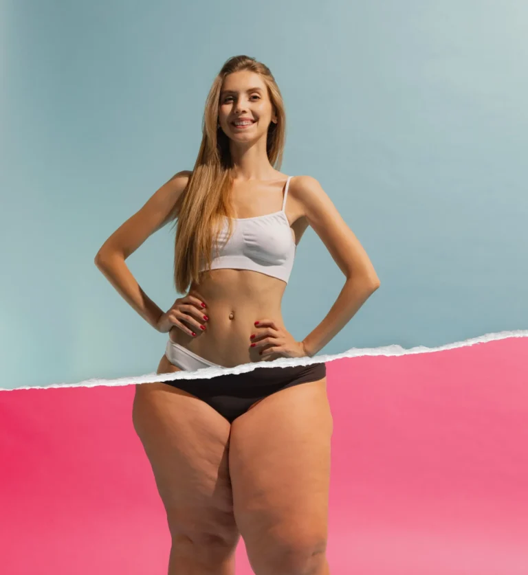 Weightloss